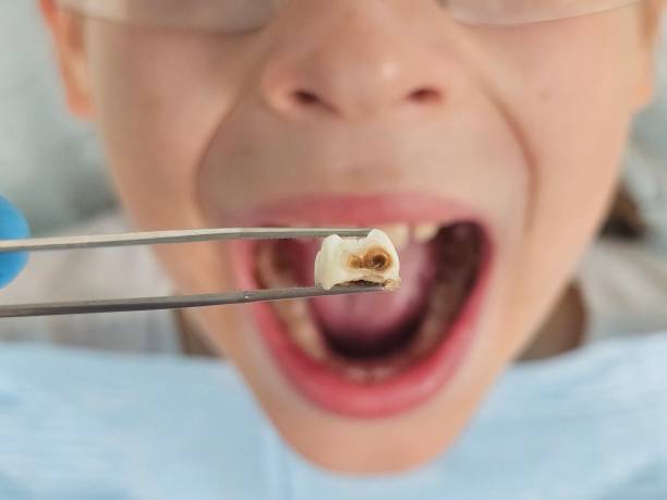 Best Broken Tooth Emergency  in Myersville, MD
