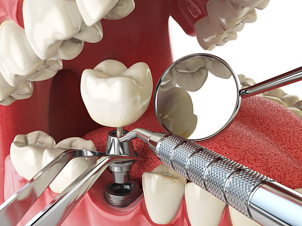 Emergency Dentist Open Today in MD